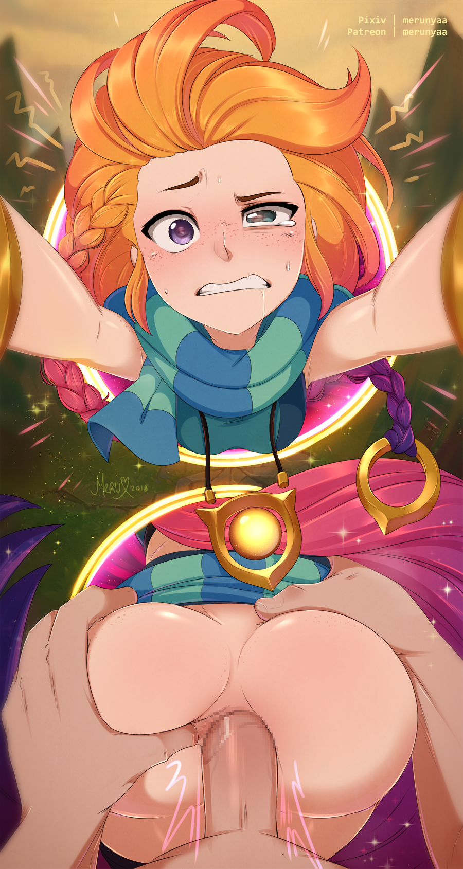 Zoe (League Of Legends) Rule 34 Image