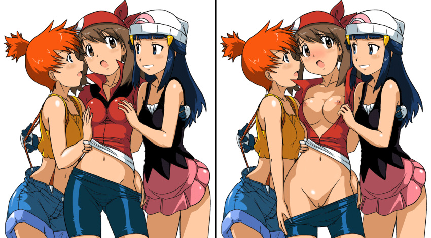 Dawn (Pokemon) Rule 34 Image