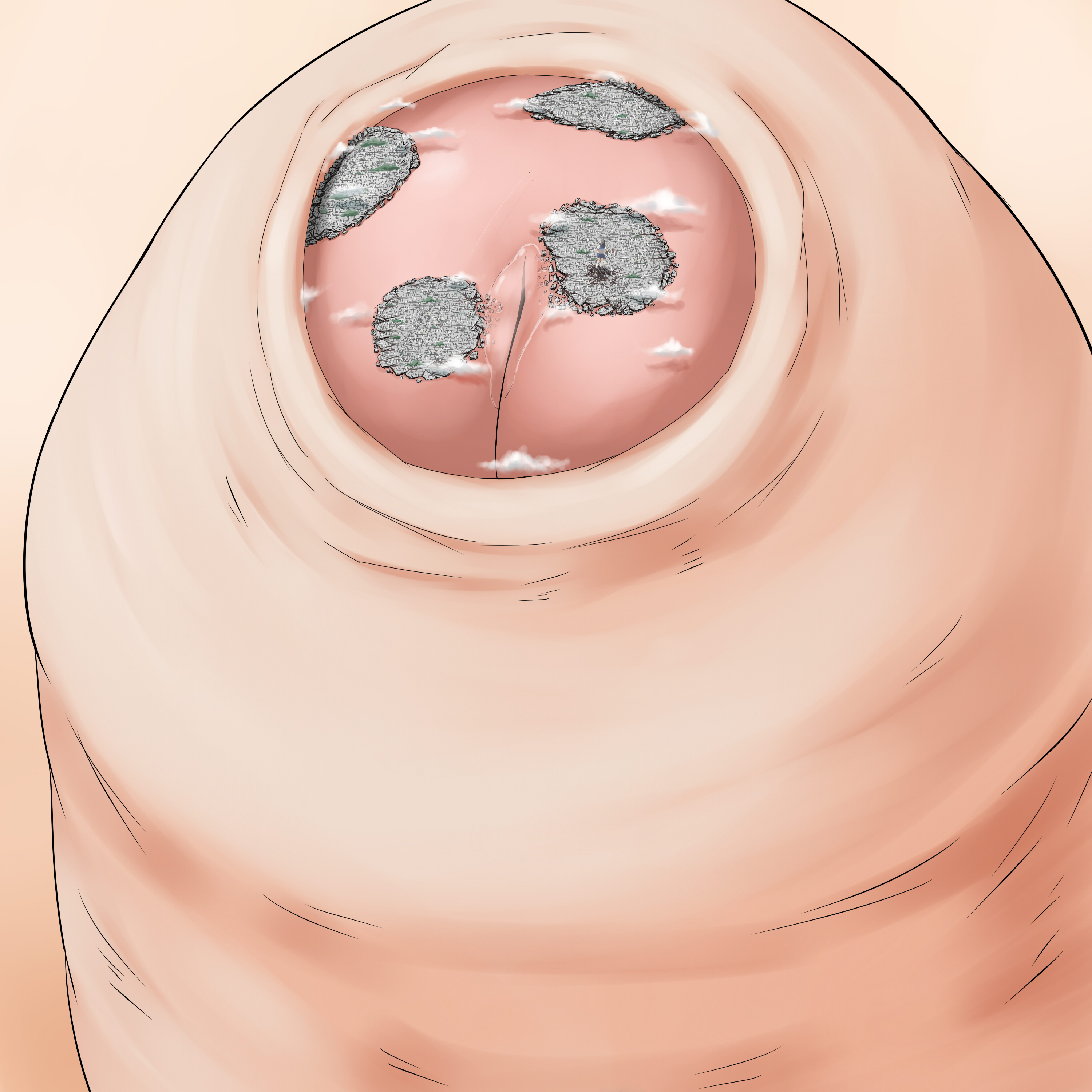 Absurd Res Rule 34 Image