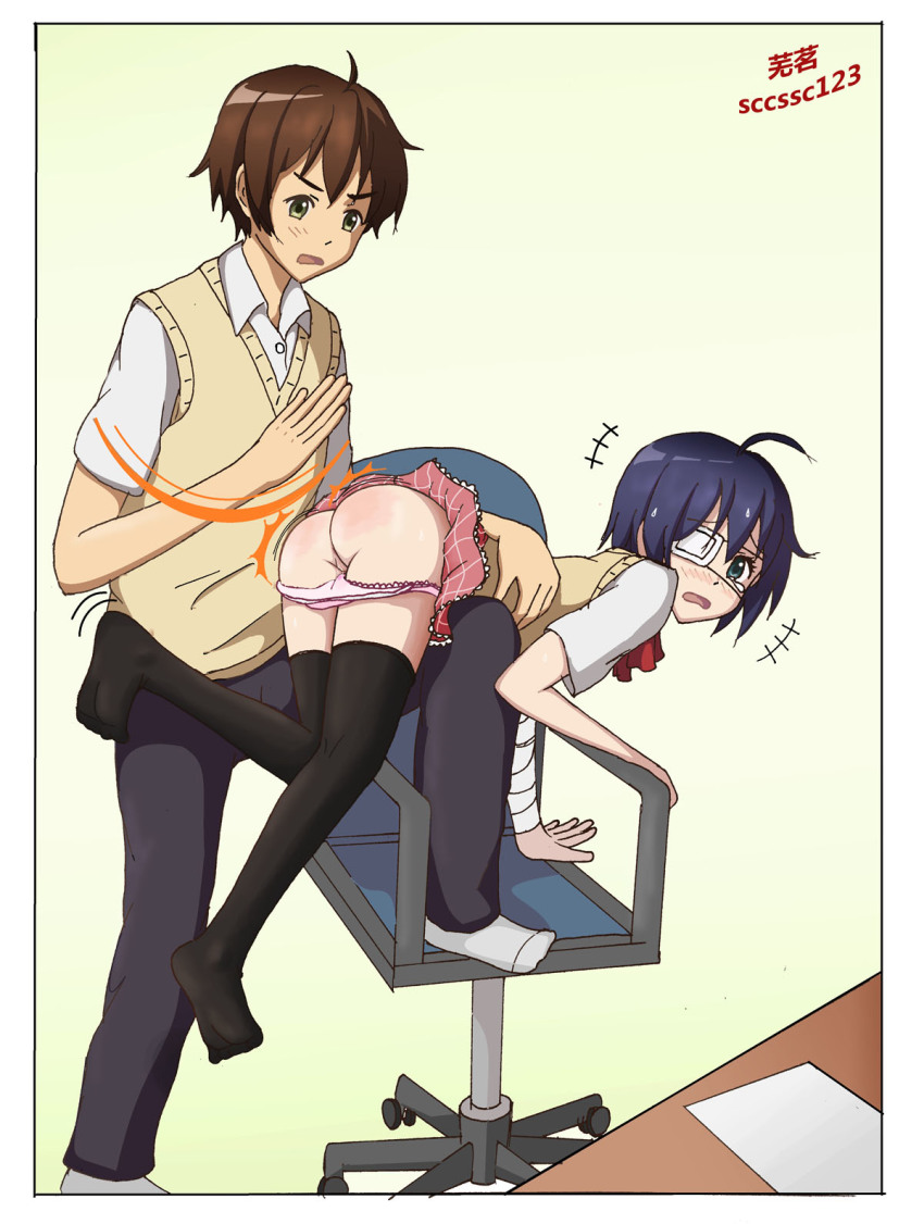 Takanashi Rikka (Chuunibyou Demo Koi Ga Shitai!) Rule 34 Image